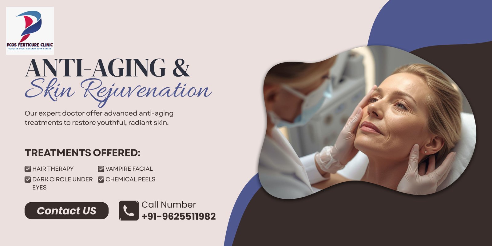 Anti aging thread lift treatment Delhi