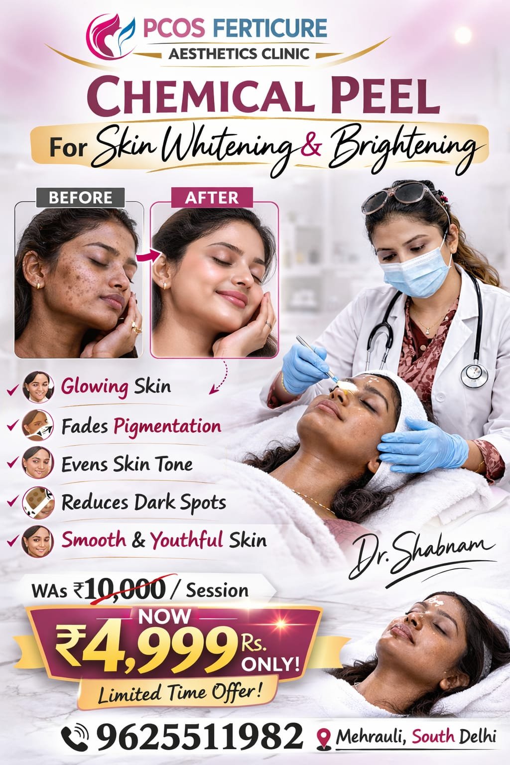 Chemical peel treatment Delhi