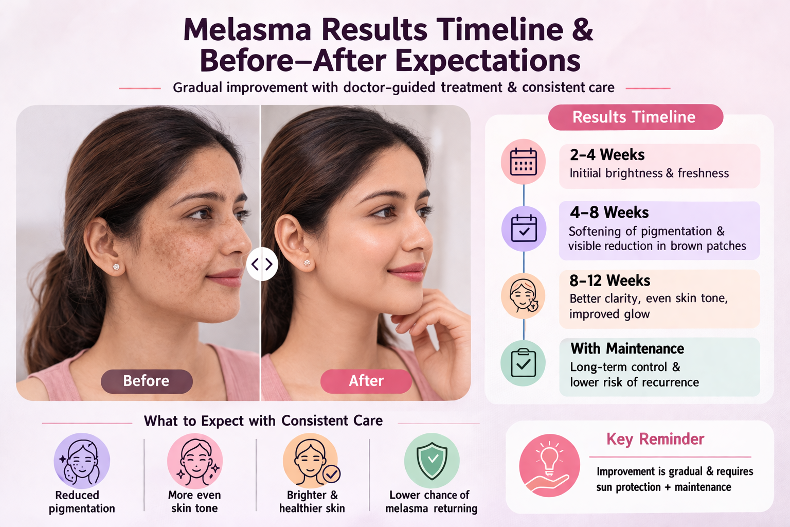 Melasma treatment results timeline showing gradual pigmentation improvement and brighter skin with doctor-guided treatment