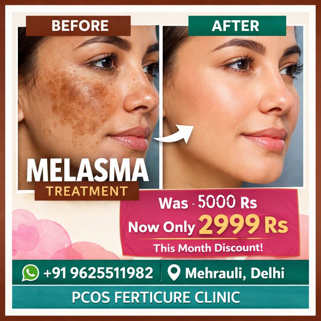 Melasma pigmentation treatment Delhi