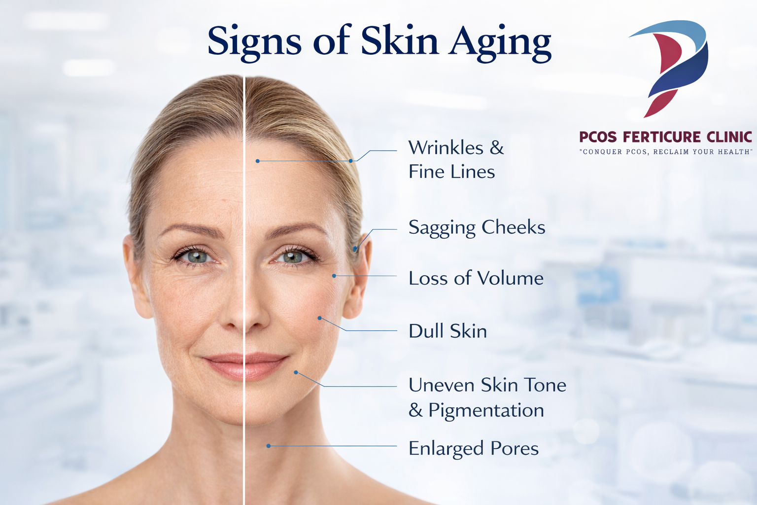 Common signs of aging including wrinkles fine lines and sagging skin