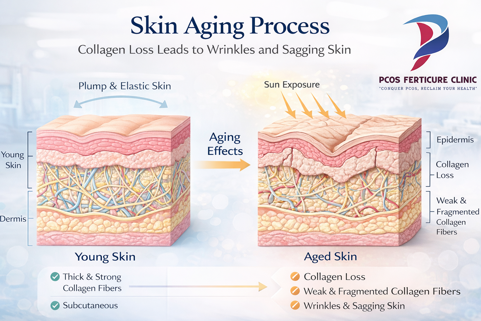 Skin aging process showing collagen loss and wrinkles