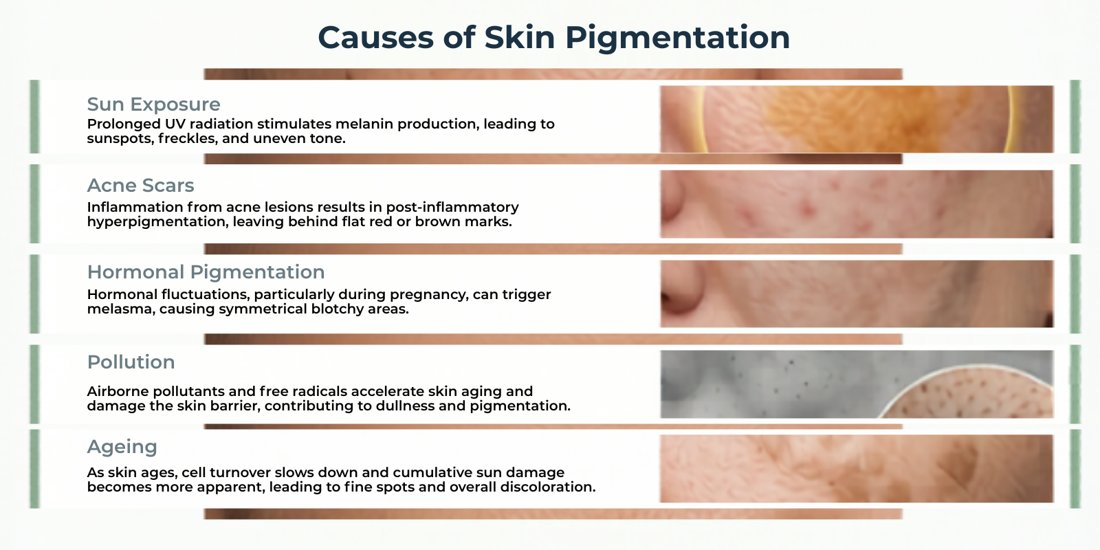 Causes of Skin Pigmentation