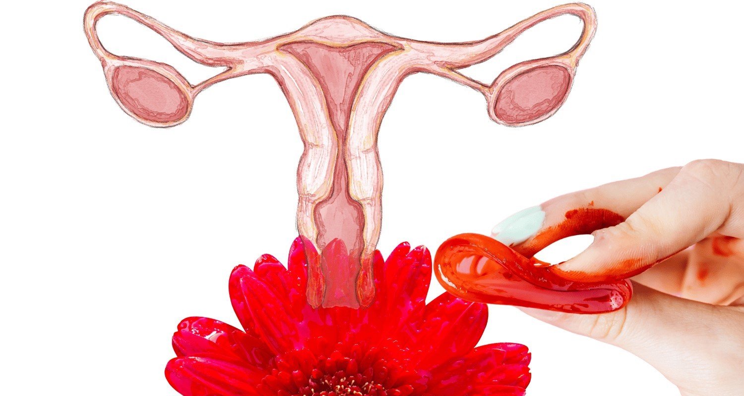 Understanding PCOD Symptoms - Dr. Shabnam Sharjil at PCOS Ferticure Clinic provides insights into common PCOD symptoms. Explore expert information, identification tips, and comprehensive strategies for managing PCOD symptoms within the context of PCOS-PCOD.