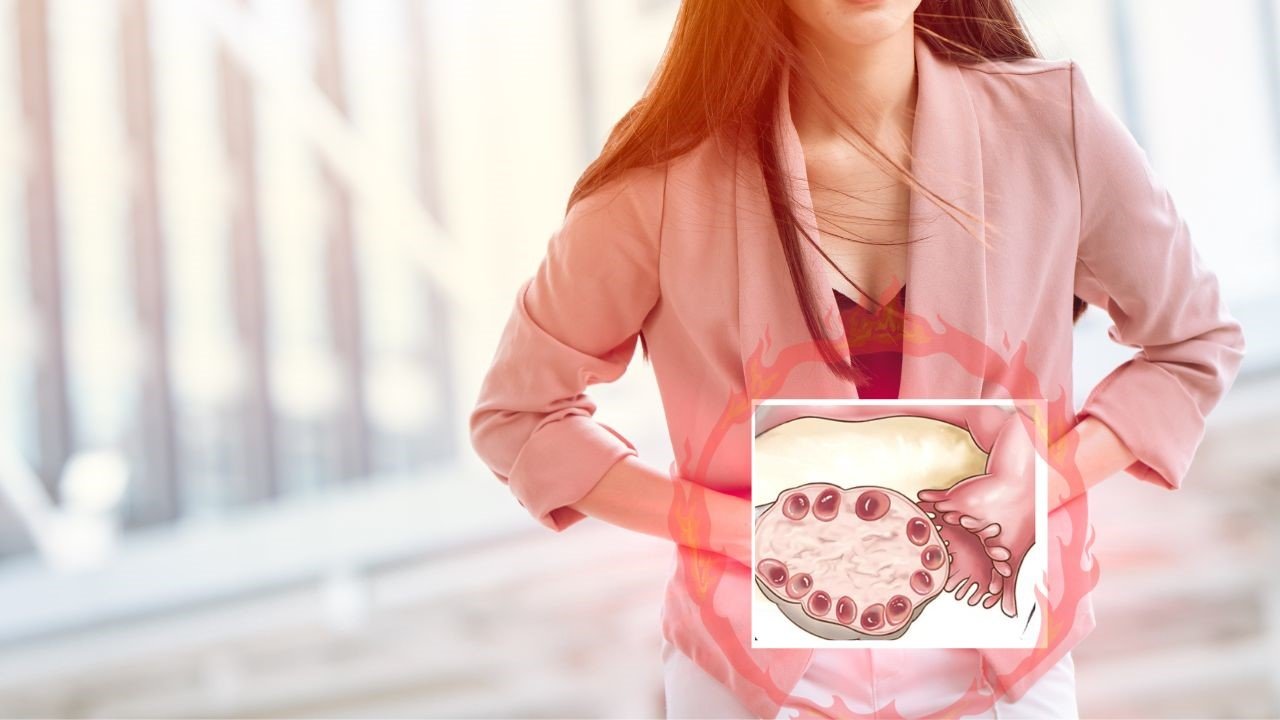 PCOS Myth Busting - Symptoms of PCOS May Vary from Woman to Woman. Dr. Shabnam Sharjil at PCOS Ferticure Clinic provides expert insights into the diverse symptoms of PCOS. Trusted information for understanding and managing PCOS for reproductive wellness.