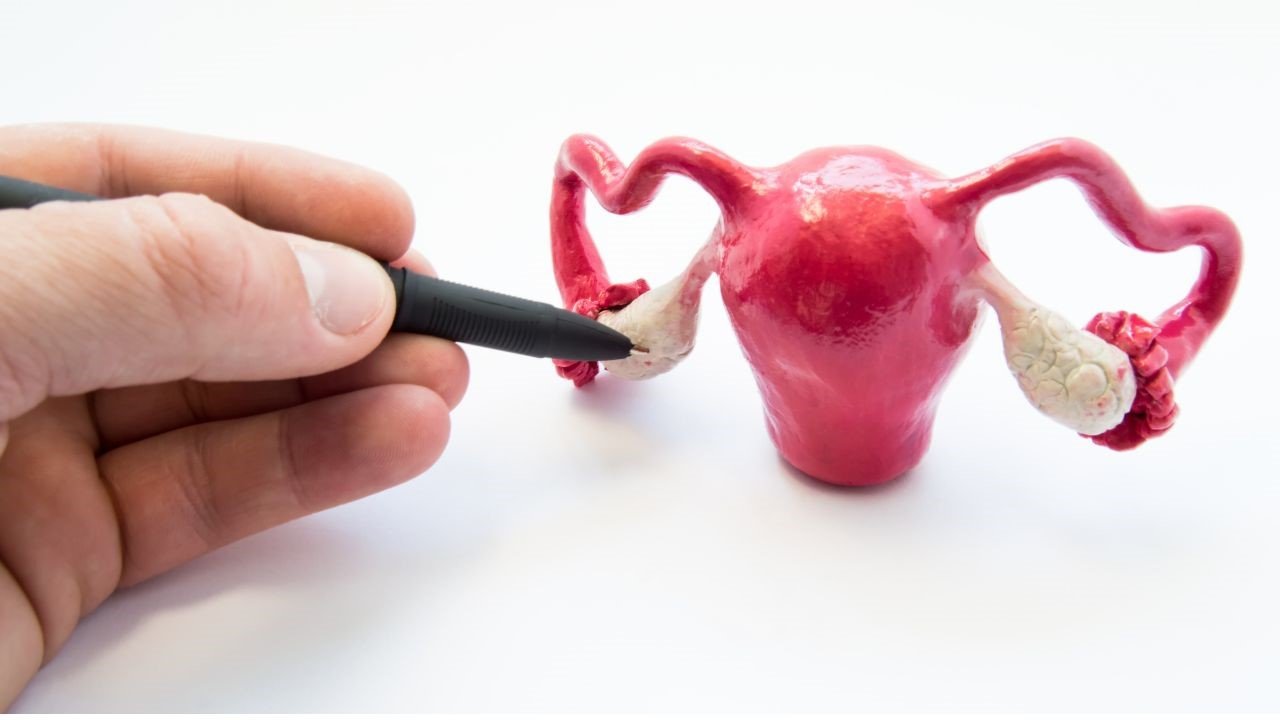 Busting the Myth about PCOS - Explore expert insights and debunked myths about PCOS with Dr. Shabnam Sharjil at PCOS Ferticure Clinic. Trusted information for understanding and managing PCOS for reproductive wellness.