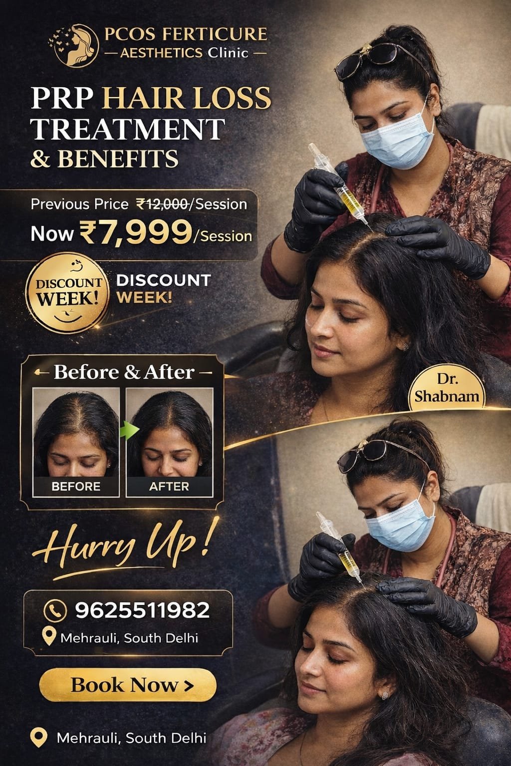 Before PRP hair treatment showing female hair thinning with widened part and visible scalp at crown