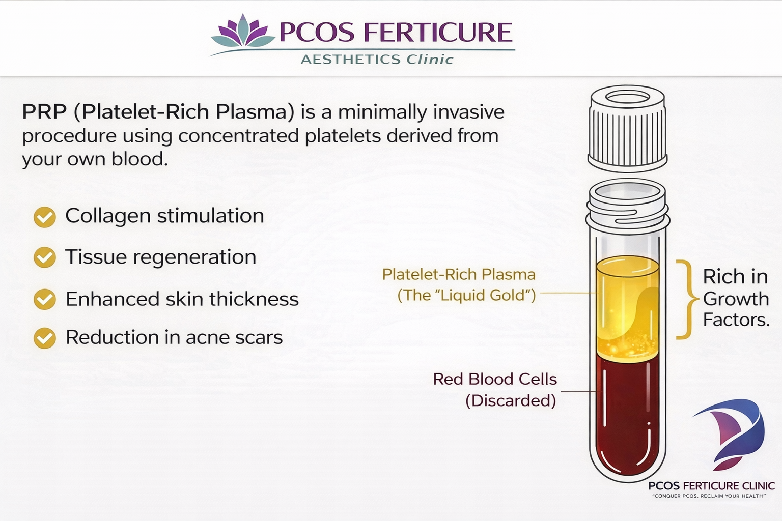 Banner explaining why PRP is one of the best treatments for dark circles, highlighting natural plasma therapy, no synthetic fillers, minimal allergy risk and gradual collagen improvement - PCOS Ferticure Clinic Delhi