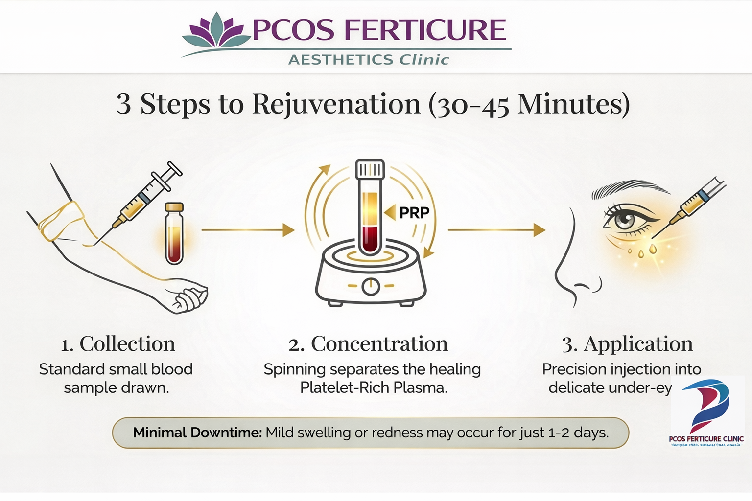 Educational banner explaining PRP facial treatment for collagen stimulation, acne scar improvement and skin rejuvenation at PCOS Ferticure Clinic Delhi