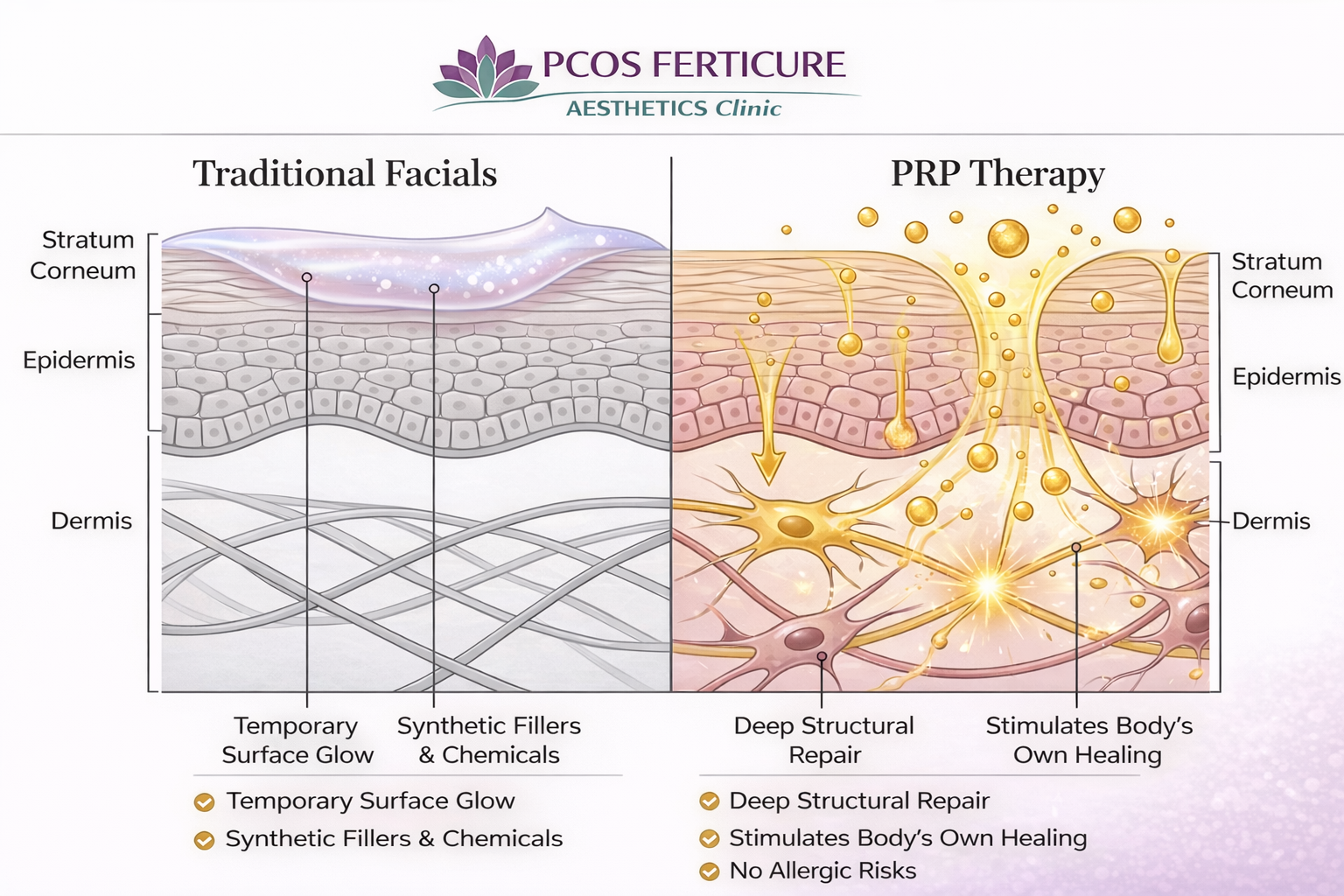 Traditional facials vs PRP therapy comparison showing skin layers, collagen stimulation, deep structural repair, and natural healing benefits at PCOS Ferticure Clinic Delhi